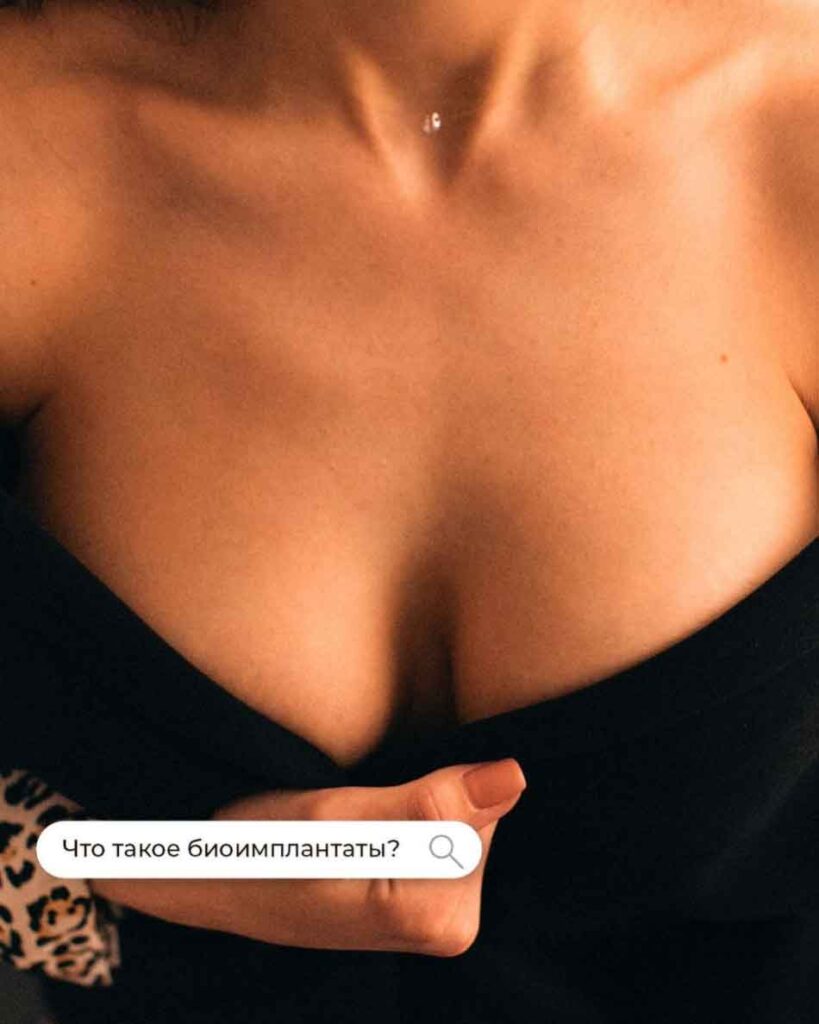 Биоимплантаты.