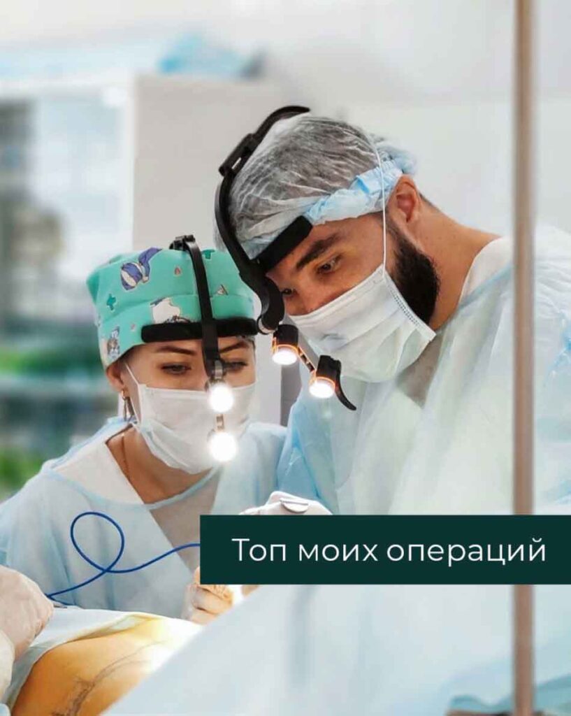 Топ моих операций.