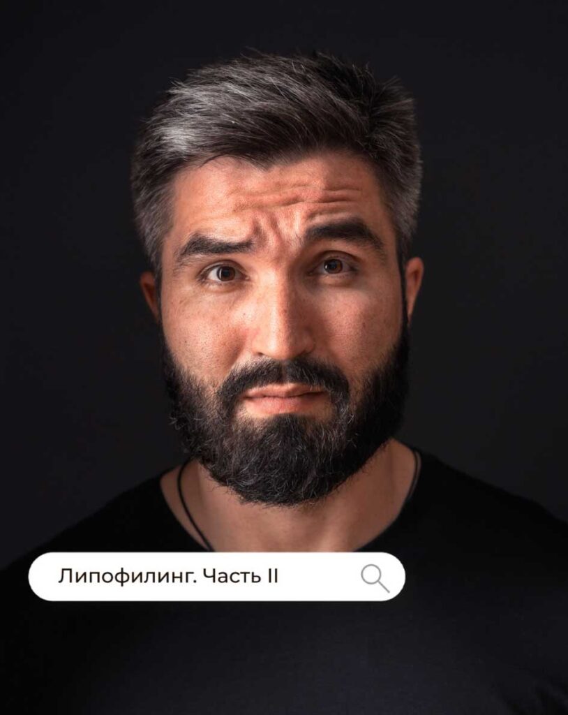 Липофилинг. Часть II.