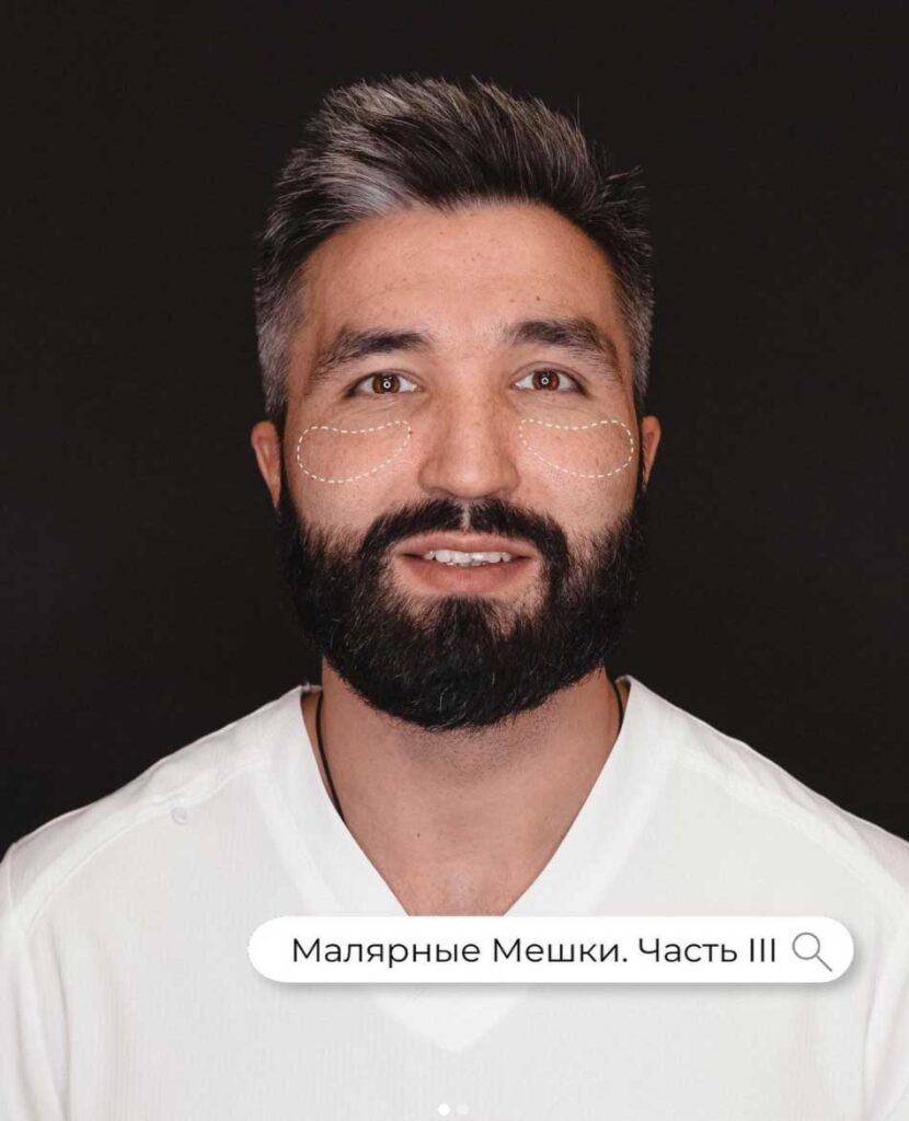 Малярные мешки. Часть третья. Полудомашняя.