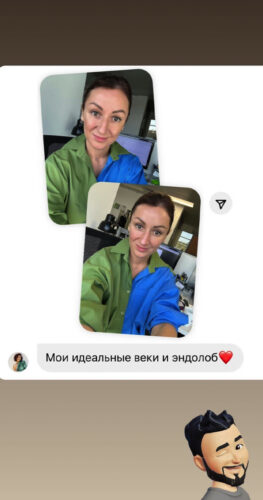 Лобно-височный лифтинг