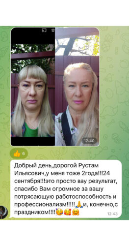 Расширенная блефаропластика