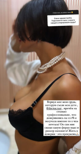 Увеличение груди