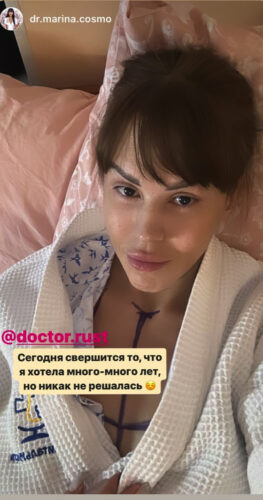 Увеличение груди