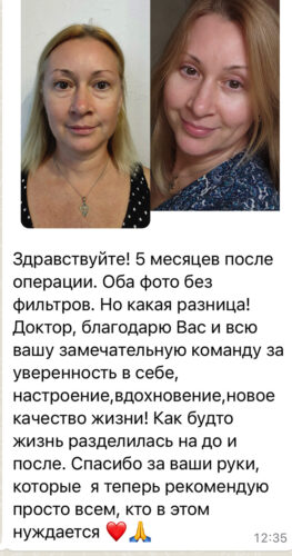 Круговая блефаропластика