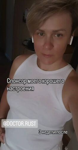 Увеличение груди