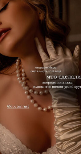 Увеличение груди