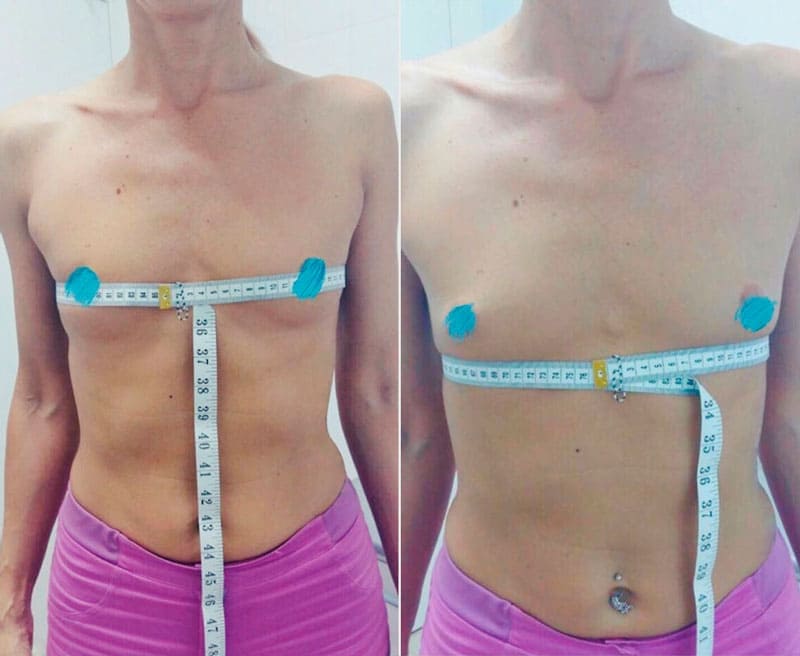 Фото для онлайн консультации. Хирург Халилуллин Р.И.