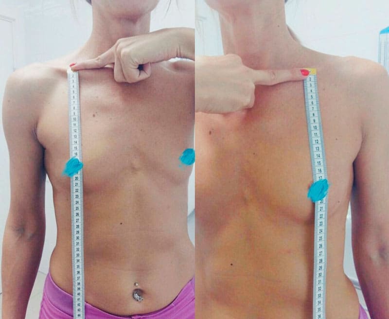 Как сделать фото для онлайн консультации. Хирург Халилуллин Р.И.