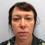 Круговая блефаропластика - до