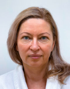 Эндоскопический лифтинг с блефаропластикой - до