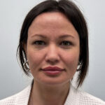 Блефаропластика и эндоскопический лифтинг - до