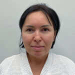 Блефаропластика и эндоскопический лифтинг - до