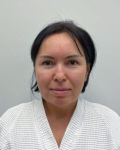 Блефаропластика и эндоскопический лифтинг - до