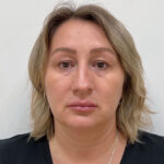 Блефаропластика и эндоскопический лифтинг - до