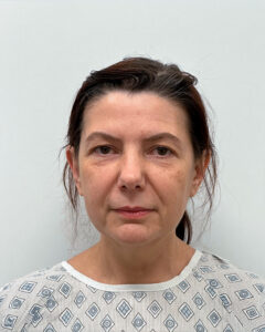 Тотальное омоложение - до