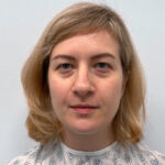 Блефаропластика и эндоскопический лифтинг - до