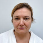 Блефаропластика и эндоскопический лифтинг - до