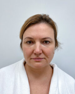 Блефаропластика и эндоскопический лифтинг - до