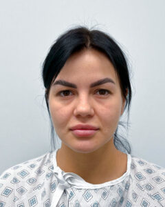 Круговая блефаропластика с эндоскопическим лифтингом - до