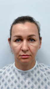 Тотальное омоложение - до