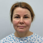 Эндоскопический лифтинг в сочетании блефаропластикой - до