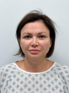 Эндоскопический лифтинг в сочетании блефаропластикой - до