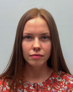 Нижняя блефаропластика - после