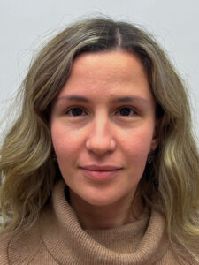 Эндоскопический лифтинг с блефаропластикой - после