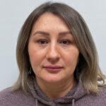 Блефаропластика и эндоскопический лифтинг - после