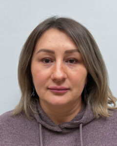 Блефаропластика и эндоскопический лифтинг - после