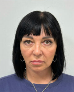 Тотальное омоложение - после