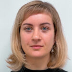 Блефаропластика и эндоскопический лифтинг - после