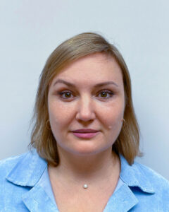 Блефаропластика и эндоскопический лифтинг - после