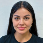 Круговая блефаропластика с эндоскопическим лифтингом - после