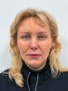 Эндоскопический лифтинг в сочетании блефаропластикой - после