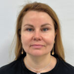 Эндоскопический лифтинг в сочетании блефаропластикой - после