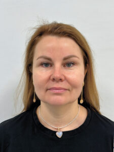 Эндоскопический лифтинг в сочетании блефаропластикой - после