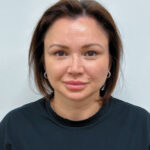 Эндоскопический лифтинг в сочетании блефаропластикой - после