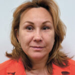 Эндоскопический лифтинг в сочетании блефаропластикой - после